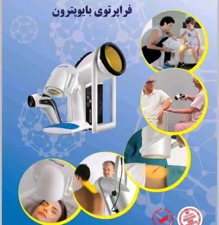 فراپرتوی بابوپترون